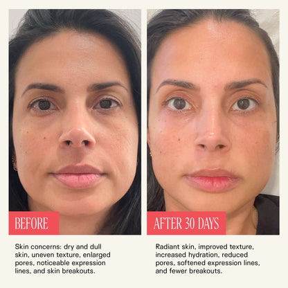 NAD+ Longevity shot™